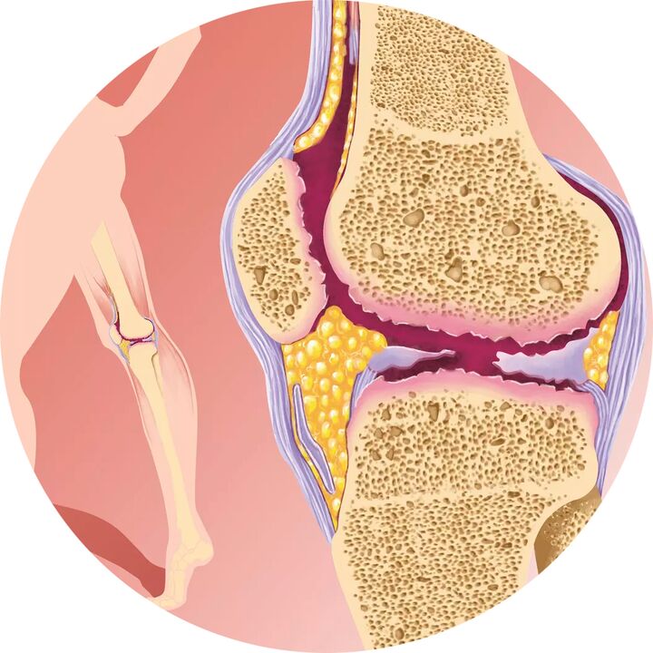 Hondroten - Soutient la mobilité articulaire